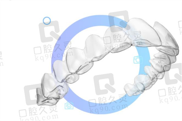 正雅隐形矫正牙套