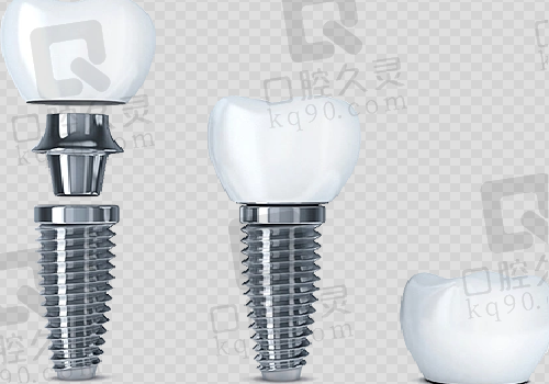 蚌埠口腔医院种植牙图