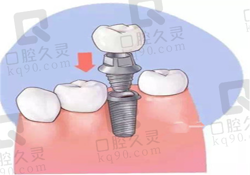 重庆渝中区口腔医院牙齿图