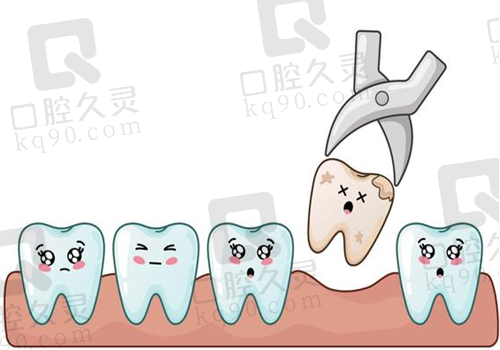 青岛拔牙图