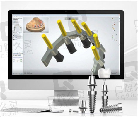 上海鼎植口腔数字化种植技术