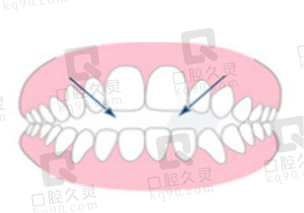 牙齿矫正