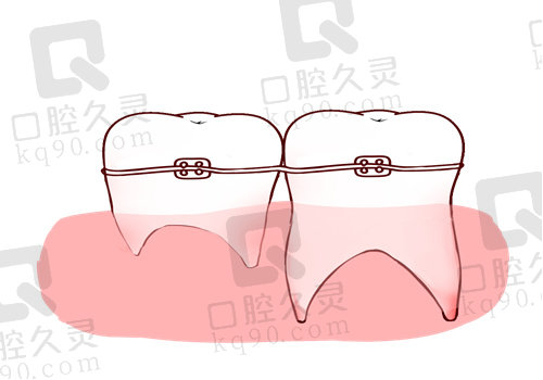 长沙牙齿矫正正规医院排名前十