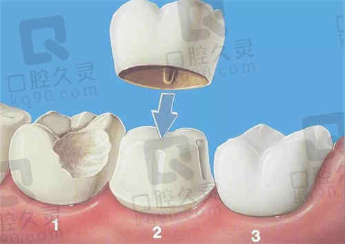 合肥佳冠口腔