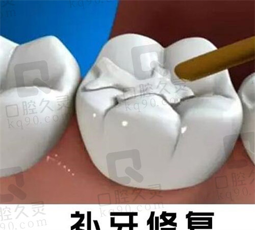 重庆牙博士修复