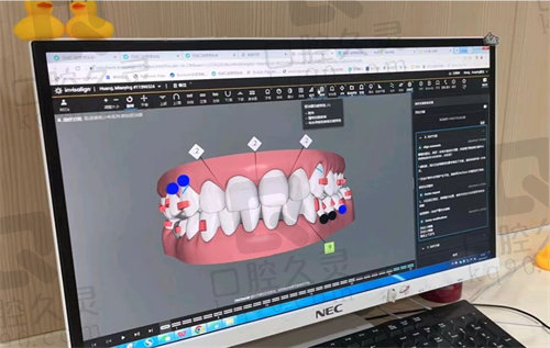 深圳同步齿科数字方案设计