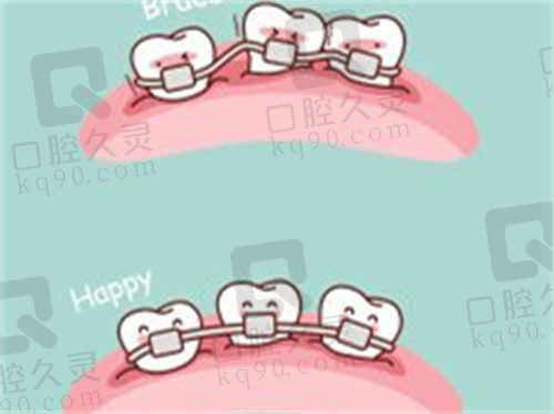 宁波恒美口腔牙齿矫正价格