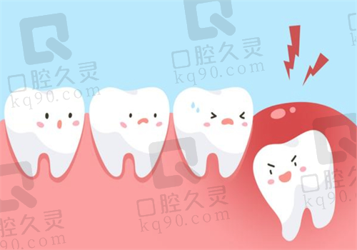 天津宝坻区口腔医院牙齿图