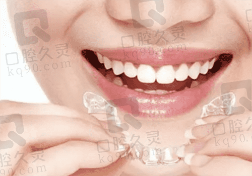 隐形牙齿矫正器