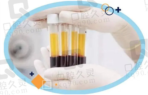 拔牙CGF是什么