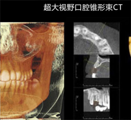 北京拜博口腔锥形束CT