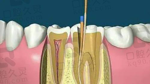 正确用药止痛