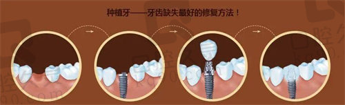 我在金水乐莎莎口腔门诊部找到了真正的自信