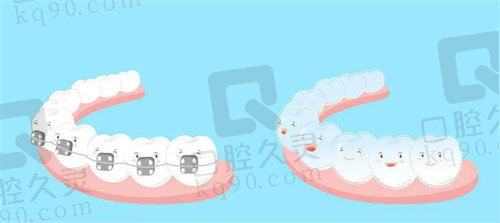 隐形矫正和金属托槽齿哪个更好