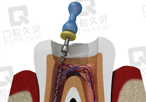 南京鼓楼区口腔医院牙齿图