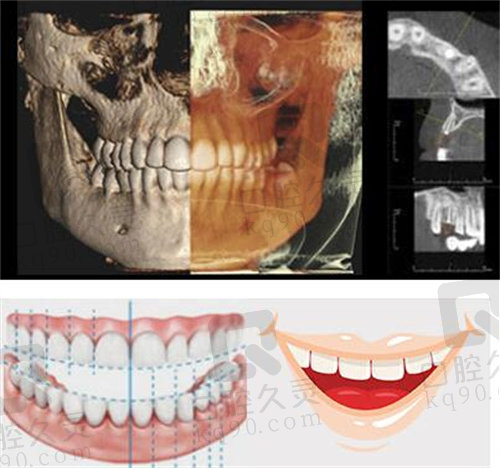 北京佳美口腔地包天矫正CT