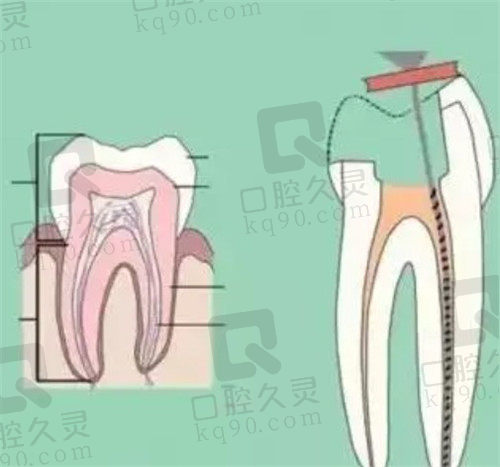 牙折的预防