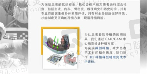 北京京植口腔数字化导板种植