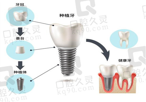 新疆阿克苏苏和口腔医院价格表查询