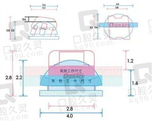 球面托槽矫正原理