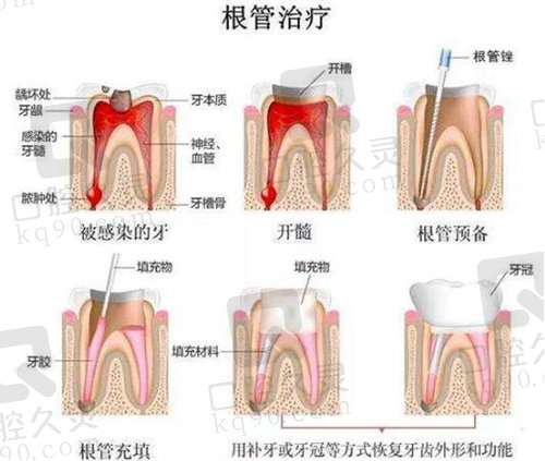 北<span style=