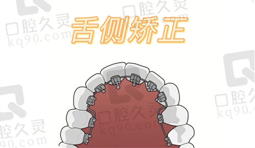 杭州美奥口腔牙齿矫正怎么样