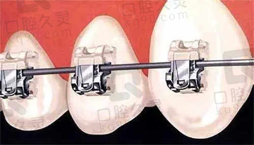商丘京德口腔医院牙齿矫正