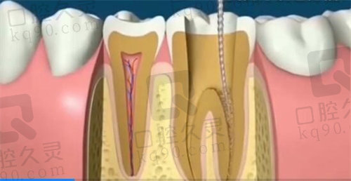 沈阳京科口腔根管治疗