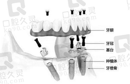 浙医二院口腔科种植牙怎么样