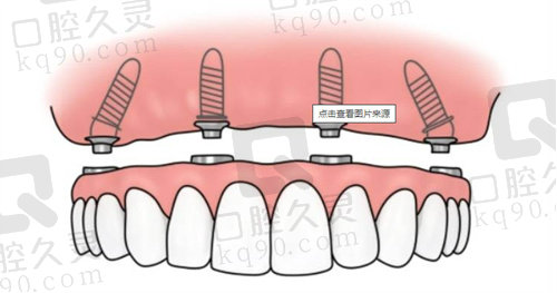 眉县誉尔蔓口腔好不好