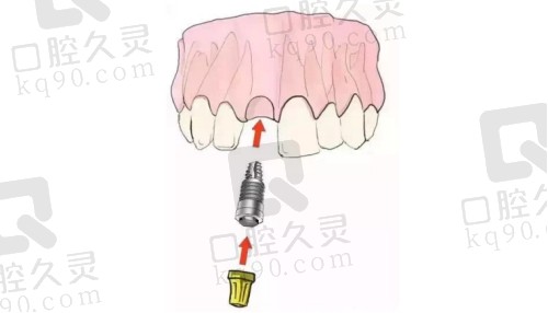 西昌口腔科好的医院排名