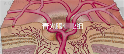 北京协和医院眼科青光眼