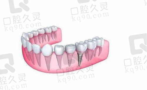 美奥口腔医院项目价格表