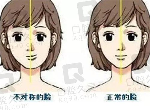 脸部歪斜和牙齿有关系吗