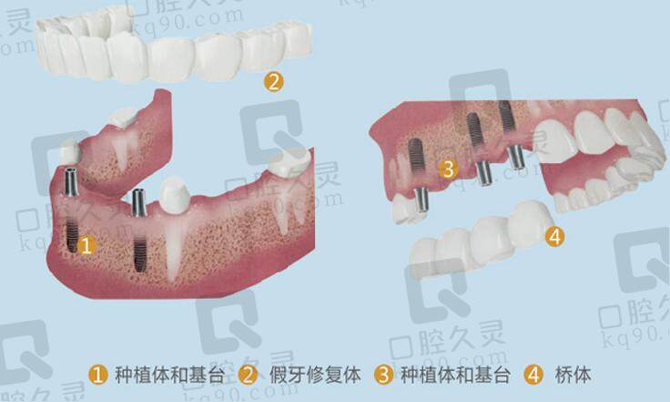 成都新桥口腔医院口碑怎么样