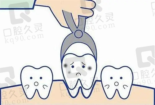 ❗杭州西湖口腔医院牙冠价格表