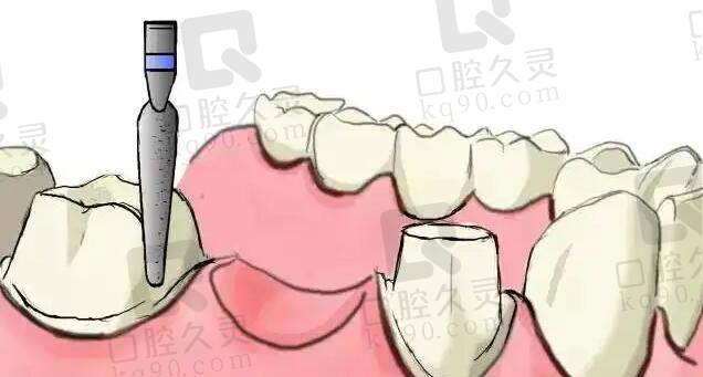 以色列雅定和韩国奥齿泰哪个好