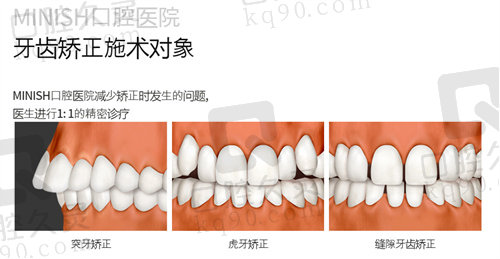 韩国Minish牙科医院牙齿矫正.jpg