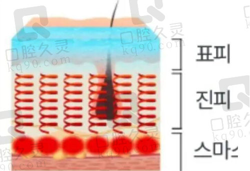 Titanium提升作用皮肤