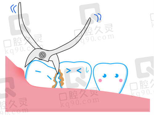 合肥中诺口腔医院拔牙价格