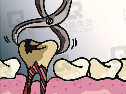 合肥中诺口腔医院拔牙价格
