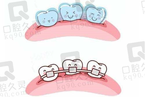 青岛胶州旺达博士口腔门诊部牙齿矫正价格