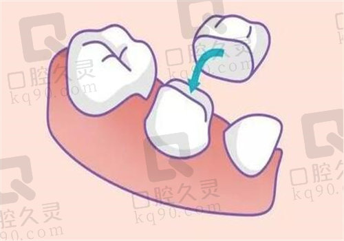 沈阳国颂口腔医院种牙结果好吗