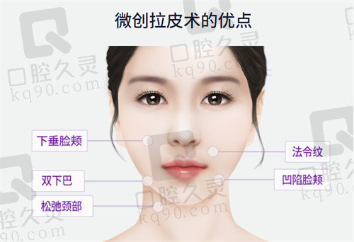 ID医院的微创拉皮术改善部位