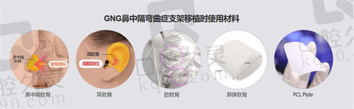 韩国GNG医院鼻中隔弯曲材料