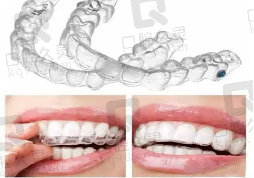 重庆瑞泰口腔温秀杰正畸技术好