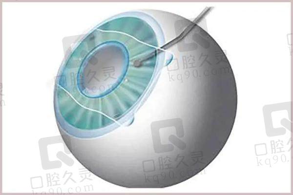 成都普瑞眼科医院地址在哪