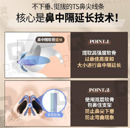 韩国TS整形双层软骨支架