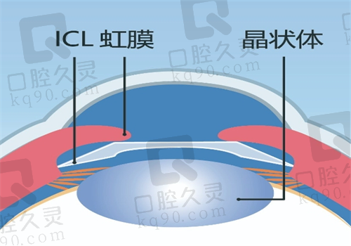 四川眼科医院周进手术图