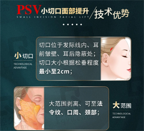 李晓东PSV小切口面部提升